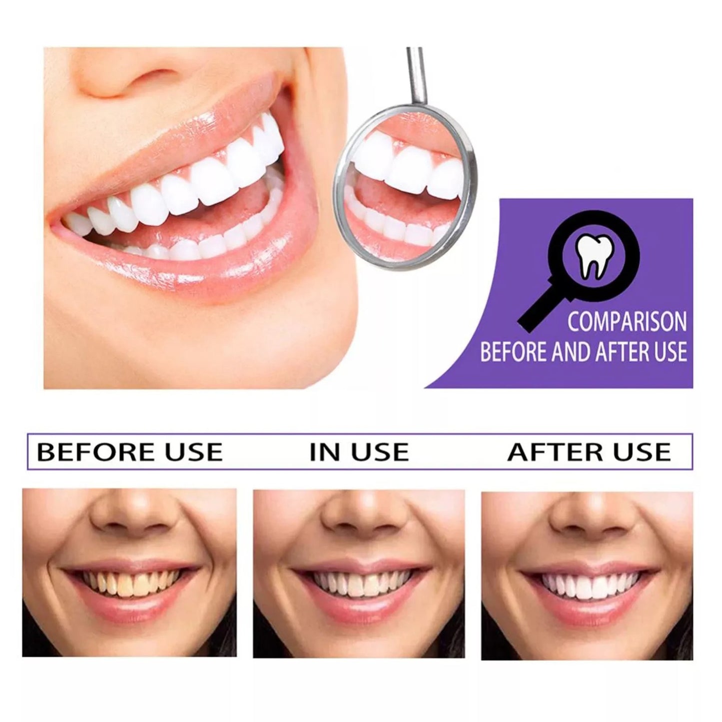 HiSmile V34 Teeth serum | Colour Corrector, Teeth Whitening, Stain Remove